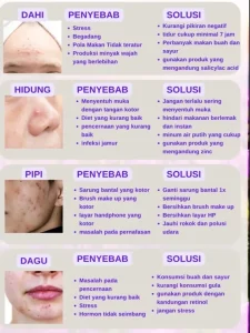 Penyebab Jerawat Dan Cara Mencegahnya Panduan Lengkap Untuk Kulit Sehat